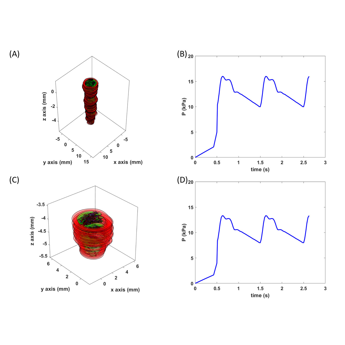 Coronary_plaque_structure_pressure